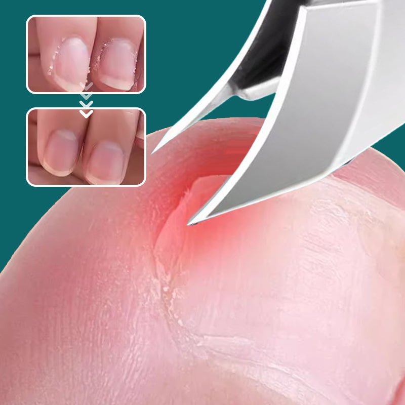 🔥2025 Hot Sale🔥 Anti-Splash 25° Slant Edge Nail Clipper 3-Piece Set – Bild 4