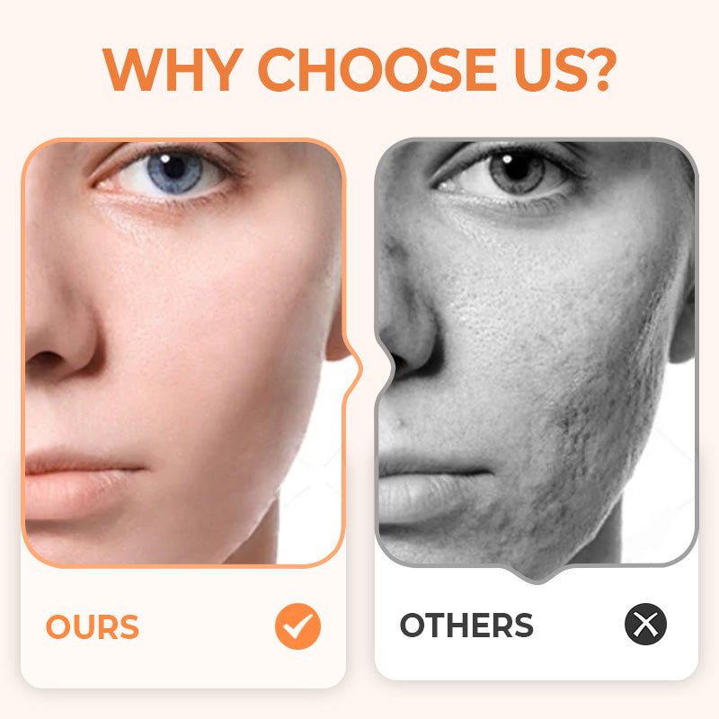 💦✨ Reusable waterproof silicone scar patch! Making scars invisible is not a dream ✨💦! – Bild 3