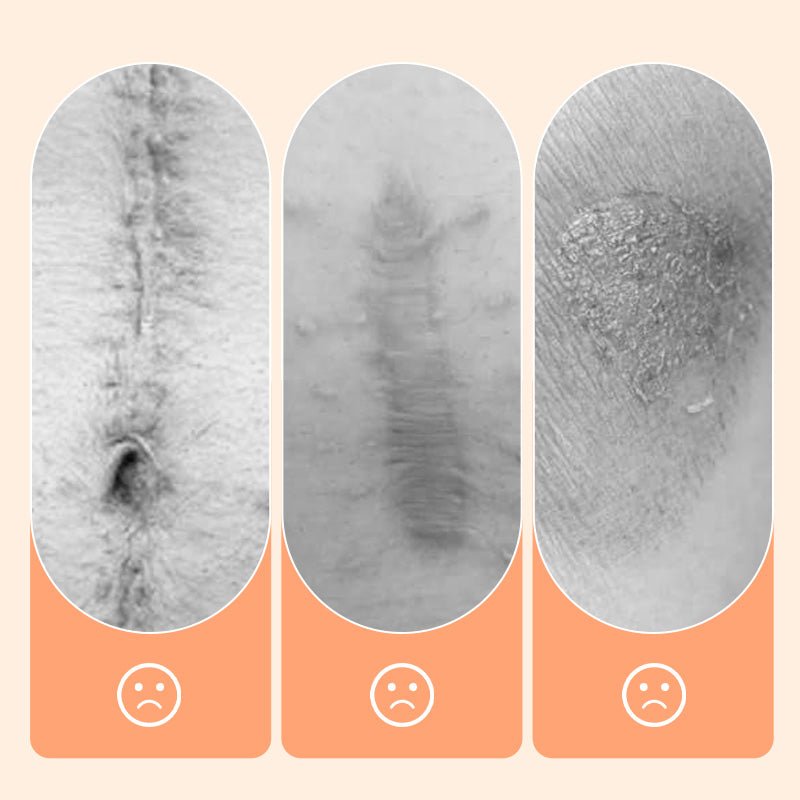 💦✨ Reusable waterproof silicone scar patch! Making scars invisible is not a dream ✨💦! – Bild 4