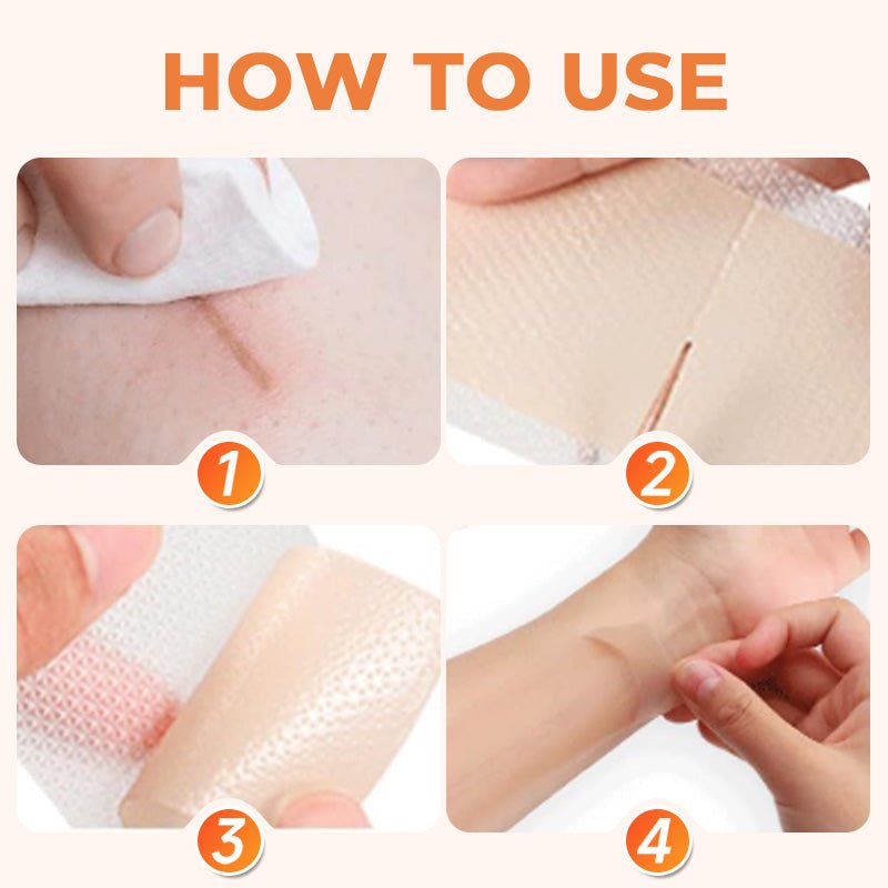 💦✨ Reusable waterproof silicone scar patch! Making scars invisible is not a dream ✨💦! – Bild 8
